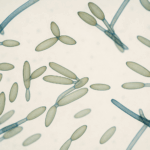 Cladosporium mikroskopiert bei 400x facher Vergrößerung